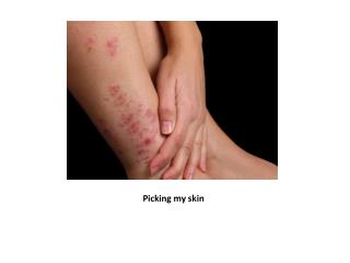 Picking my skin