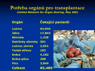 Potřeba orgánů pro transplantace ( United Network for Organ Sharing , May 200)