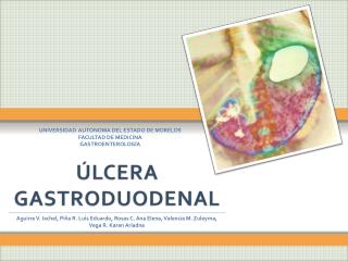 ÚLCERA GASTRODUODENAL