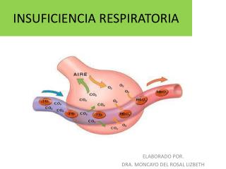 INSUFICIENCIA RESPIRATORIA