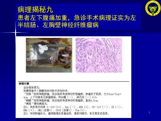 病理揭秘九 患者左下腹痛加重，急诊手术病理证实为左半结肠、左胸壁神经纤维瘤病