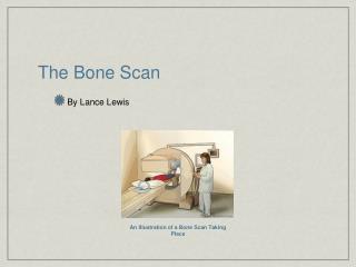 The Bone Scan