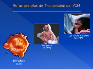 Rutas posibles de Transmisión del VIH _____________________________