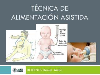 Técnica de alimentación asistida