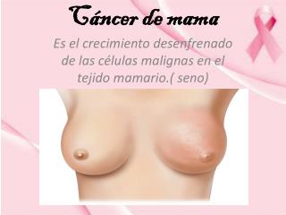 Cáncer de mama