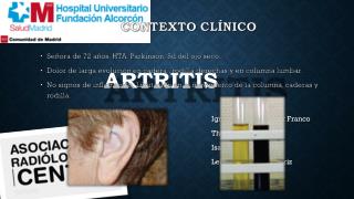 ARTRITIS
