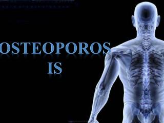 Osteoporosis