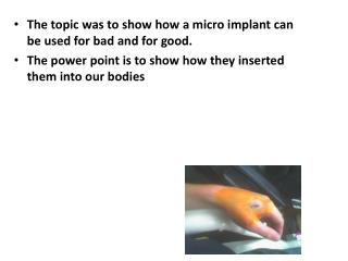 The topic was to show how a micro implant can be used for bad and for good.