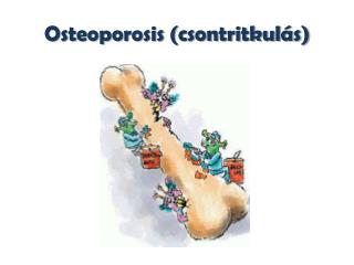 Osteoporosis (csontritkulás)