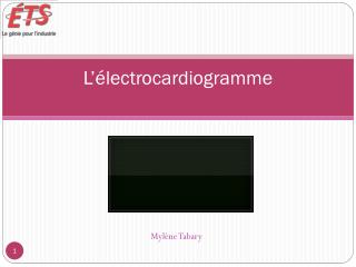 L’électrocardiogramme