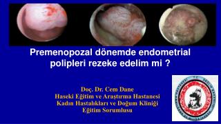 Premenopozal dönemde endometrial polipleri rezeke edelim mi ?