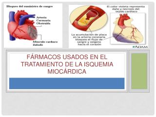 Fármacos usados en el tratamiento de la isquemia Miocárdica