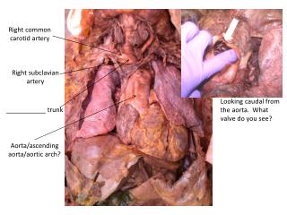 Aorta/ascending aorta/aortic arch?