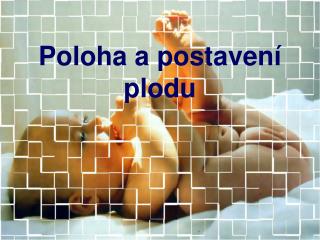 Poloha a postavení plodu