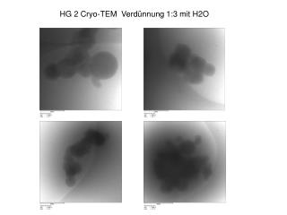 HG 2 Cryo-TEM Verdünnung 1:3 mit H2O