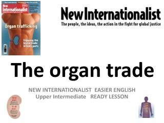 The organ trade