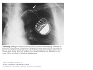 Trappe, Hans-Joachim; Gummert , Jan Aktuelle Schrittmacher- und Defibrillatortherapie