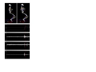 A . B. C. Lumbar Flexion D. R-Erector Spinae