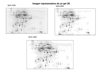 Imagen representativa de un gel 2D