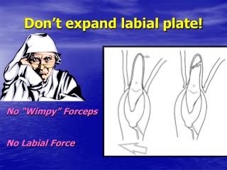 Don’t expand labial plate!