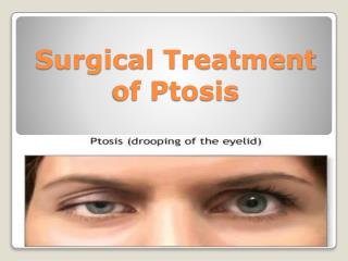 Surgical Treatment of Ptosis