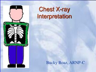 Chest X-ray Interpretation