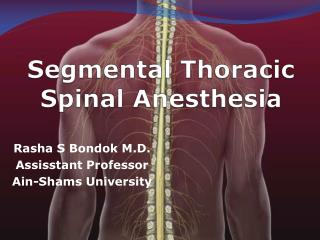 Segmental Thoracic Spinal Anesthesia