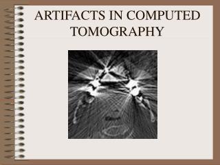 ARTIFACTS IN COMPUTED TOMOGRAPHY