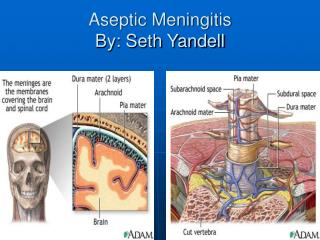 Aseptic Meningitis By: Seth Yandell