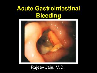 Acute Gastrointestinal Bleeding