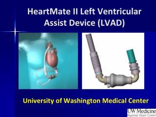 HeartMate II Left Ventricular Assist Device (LVAD)