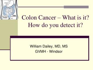 Colon Cancer – What is it? How do you detect it?
