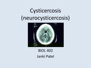 Cysticercosis (neurocysticercosis)