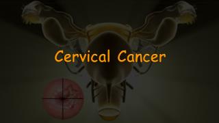 Cervical C ancer