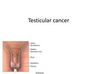 Testicular cancer