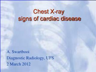 Chest X-ray signs of cardiac disease