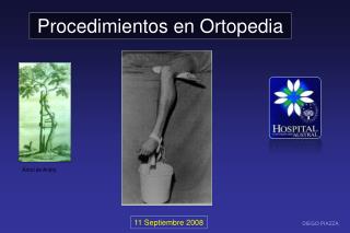 Procedimientos en Ortopedia