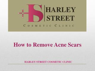 How to Remove Acne Scars