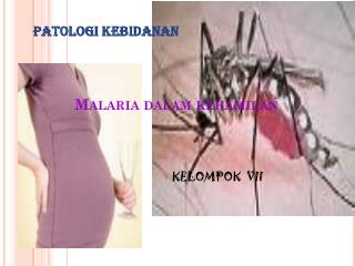 Malaria dalam kehamilan