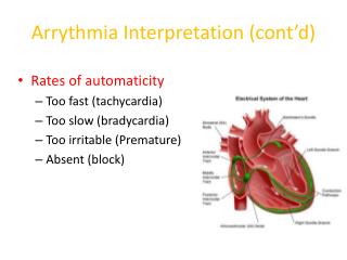 Arrythmia Interpretation (cont’d)