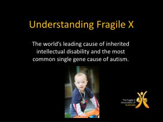 Understanding Fragile X