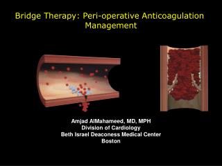 Bridge Therapy: Peri-operative Anticoagulation Management Amjad AlMahameed, MD, MPH