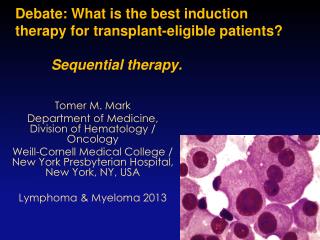 Debate: What is the best induction therapy for transplant-eligible patients? Sequential therapy.
