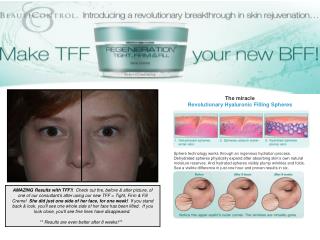 The miracle Revolutionary Hyaluronic Filling Spheres