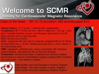 Case of the week – 06-12: Coarctation, MS and bicuspid AoV