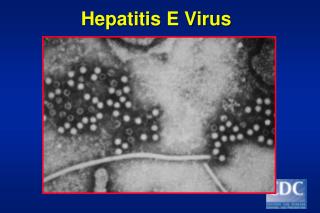 Hepatitis E Virus