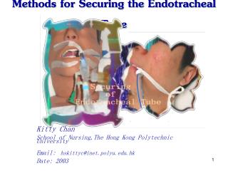 Methods for Securing the Endotracheal Tube