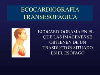 ECOCARDIOGRAFIA TRANSESOFÁGICA