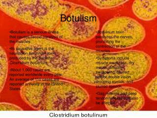 Botulism