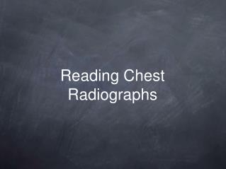 Reading Chest Radiographs